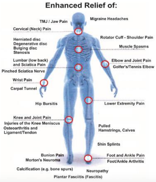 laser therapy